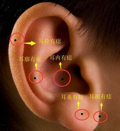 耳骨有痣|耳朵长痣的位置图解 耳朵长痣的位置图解有福气